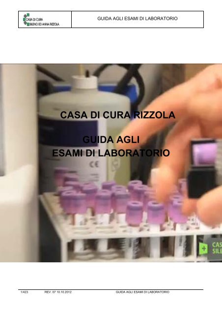 antigene prostatico specifico 2 215 ng ml 0 00 price