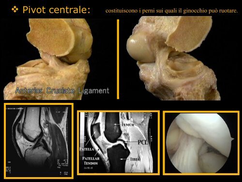 Inquadramento anatomo-funzionale del ginocchio