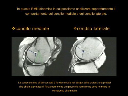 Inquadramento anatomo-funzionale del ginocchio