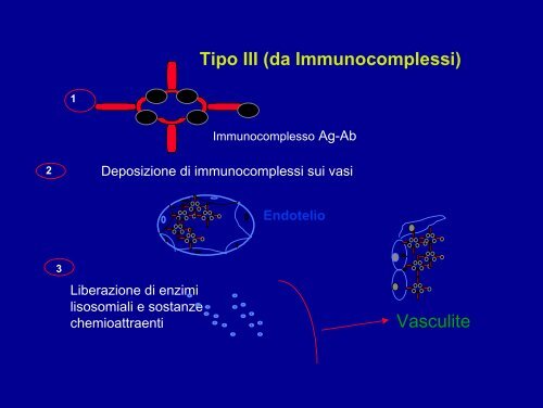 vasculiti da farmaci