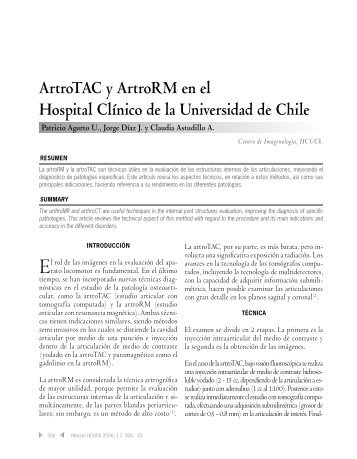 ArtroTAC y artroRM en el HCUCh. Patricio Agurto, Jorge D&iacuteaz ...