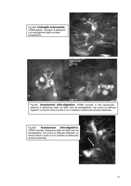 Appunti di RM - 1a parte - Fegato,vie biliari e pancreas