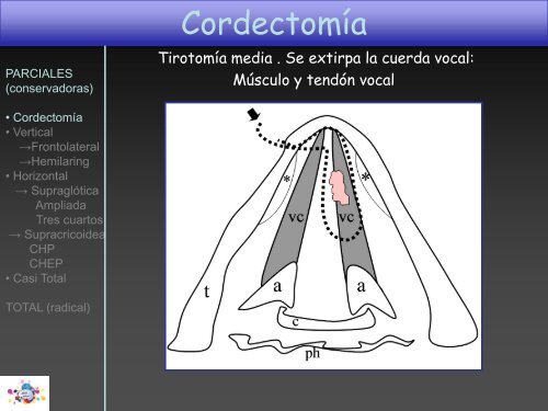 TOMOGRAFÍA COMPUTARIZADA en FIBROSIS QUÍSTICA