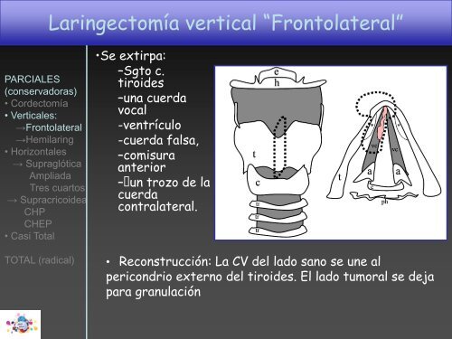 TOMOGRAFÍA COMPUTARIZADA en FIBROSIS QUÍSTICA