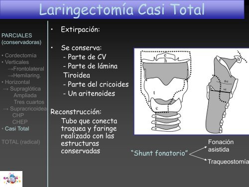 TOMOGRAFÍA COMPUTARIZADA en FIBROSIS QUÍSTICA