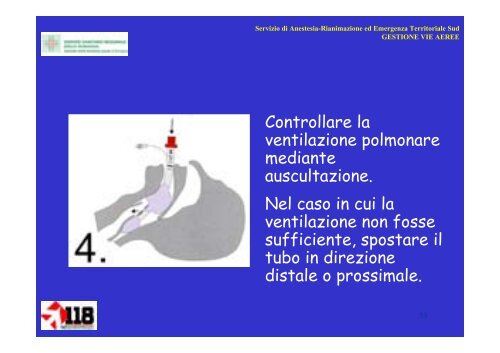 Gestione vie aeree con presidi di base e tubo laringeo - 118er