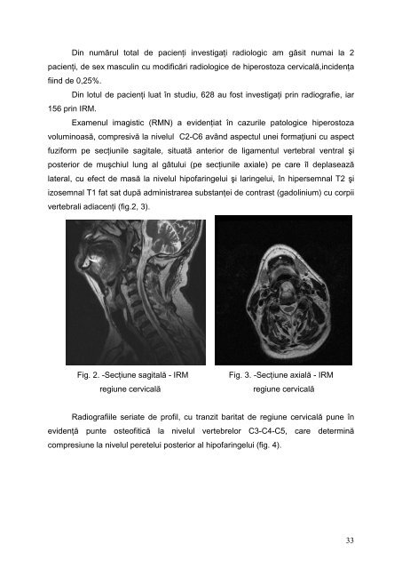 rezumat tez doctorat repere anatomo-imagistice ale ... - Gr.T. Popa