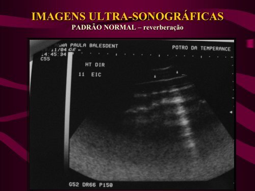 imagens ultra-sonográficas de pleuropneumonia em eqüinos