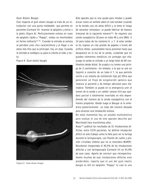 Alternativas en el manejo del paciente con via aerea dificil