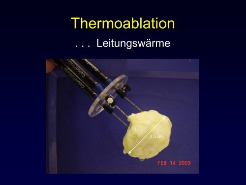 Radiologische Diagnostik und Therapie von Tumorerkrankungen