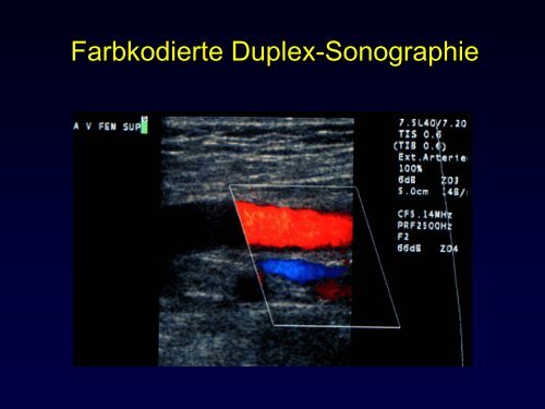 Radiologische Diagnostik und Therapie von Tumorerkrankungen