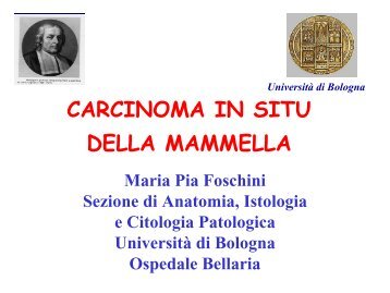 I carcinomi in situ - prima parte - Maria Pia Foschini - Saluter