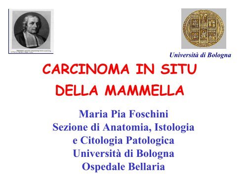 I carcinomi in situ - prima parte - Maria Pia Foschini - Saluter