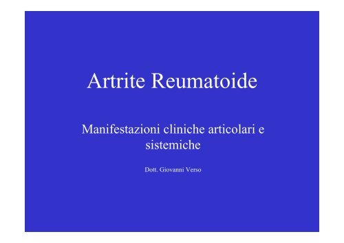 Artrite Reumatoide - ASL n. 4 Chiavarese