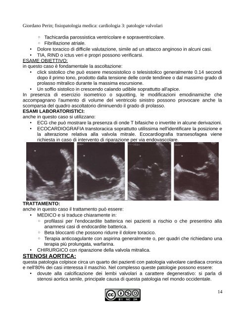 PATOLOGIE DELLE VALVOLE CARDIACHE - AppuntiMed