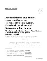 Adenoidectomía bajo control visual con técnica - ACORL