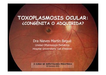 toxoplasmosis ocular - Upiip