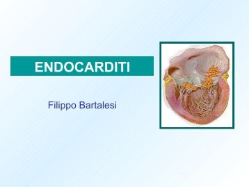 Endocarditi - Medicina e Chirurgia