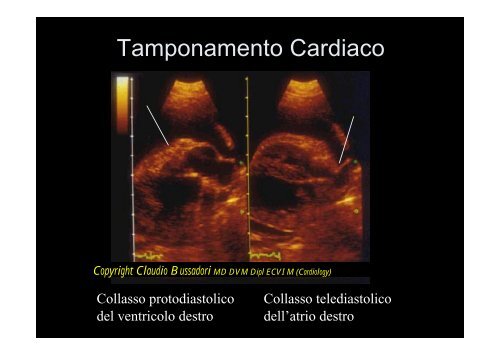 I Segni Ecocardiografici - Esaote