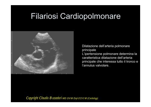 I Segni Ecocardiografici - Esaote