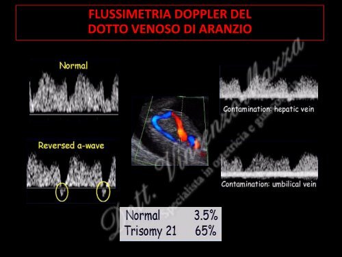 Presentazione sul test combinato.pdf - Dottorvincenzomazza.it