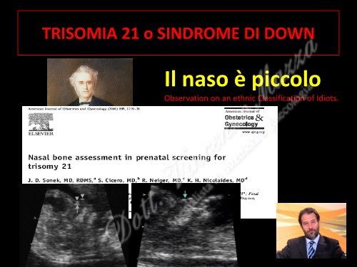 Presentazione sul test combinato.pdf - Dottorvincenzomazza.it