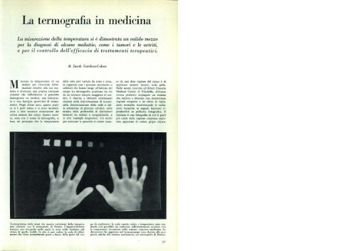 La termografia in medicina - Kataweb