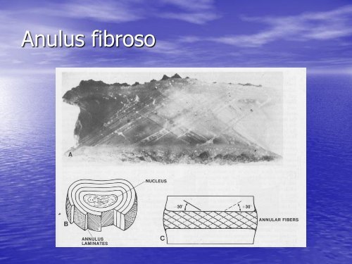 La patologia discoartrosica - Facoltà di Medicina e Chirurgia