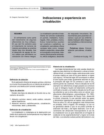 indicaciones y experiencia en crioablación - edigraphic.com