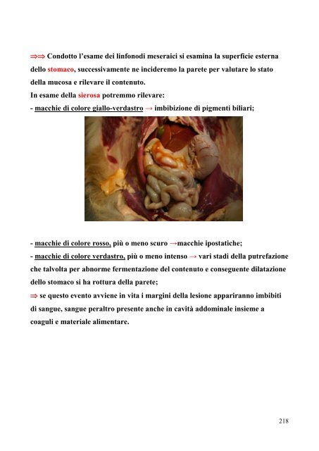 Talvolta La Parete Intestinale Invaginata è Necrotica