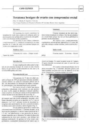 Teratoma benigno de ovario con compromiso rectal - ACACI