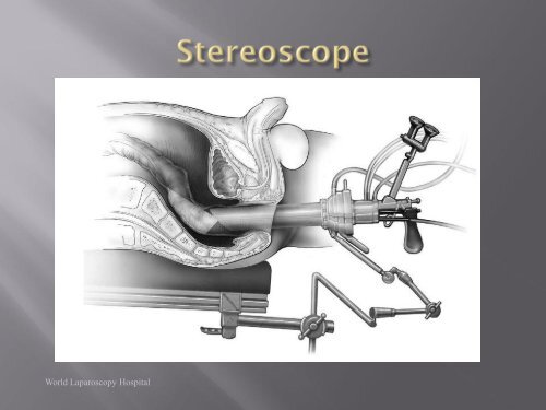 Transanal Endoscopic Microsurgery The file size in 5 to 15mb will ...