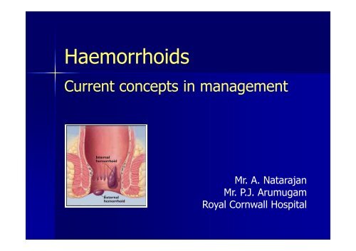 Haemorrhoids - Colorectal Surgeon