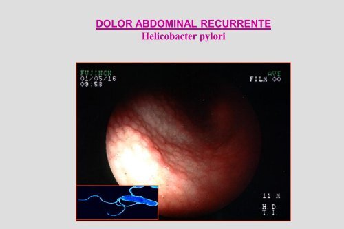 Dolor Abdominal Recurrente Dr. Cueto Rua.pdf - codajic