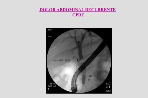 Dolor Abdominal Recurrente Dr. Cueto Rua.pdf - codajic