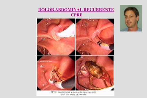 Dolor Abdominal Recurrente Dr. Cueto Rua.pdf - codajic