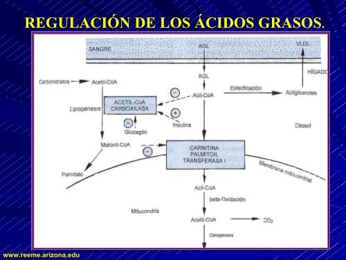 CETOACIDOSIS DIABETICA