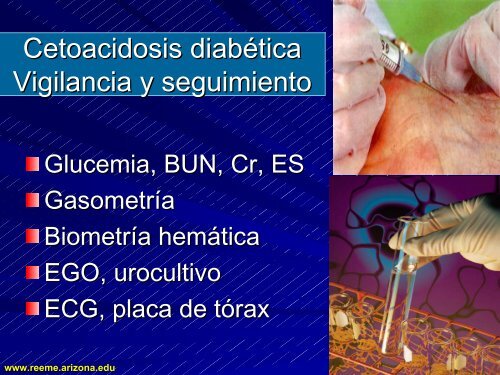 CETOACIDOSIS DIABETICA