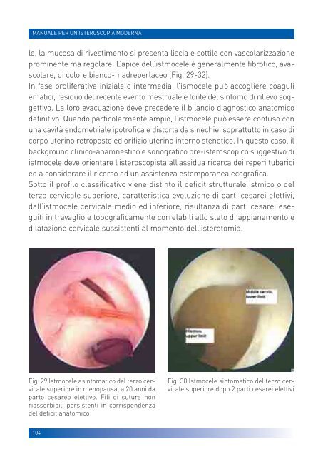 manuale per un'isteroscopia moderna - Ginecologia