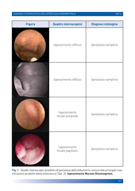 manuale per un'isteroscopia moderna - Ginecologia