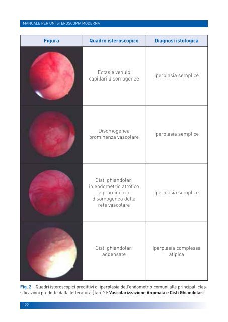 manuale per un'isteroscopia moderna - Ginecologia