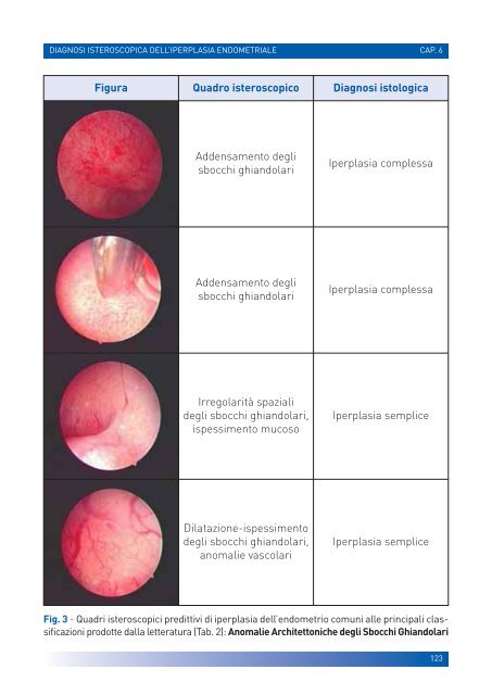 manuale per un'isteroscopia moderna - Ginecologia