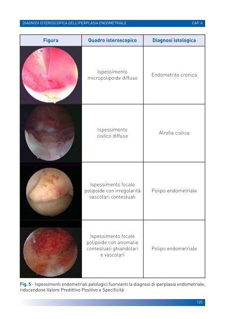 manuale per un'isteroscopia moderna - Ginecologia