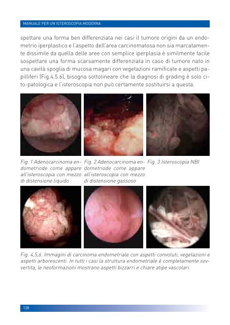 manuale per un'isteroscopia moderna - Ginecologia