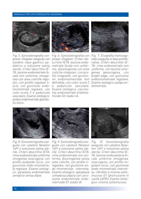 manuale per un'isteroscopia moderna - Ginecologia