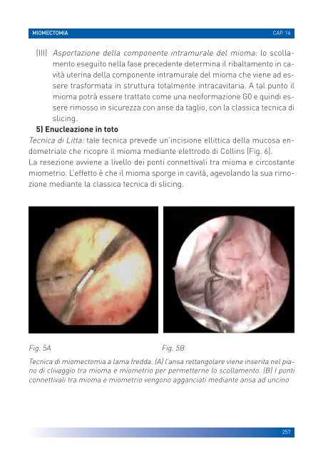 manuale per un'isteroscopia moderna - Ginecologia