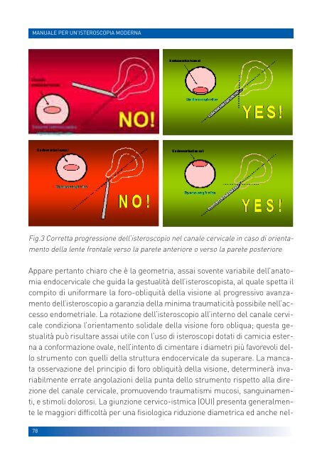 manuale per un'isteroscopia moderna - Ginecologia