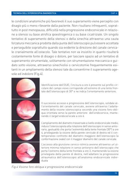 manuale per un'isteroscopia moderna - Ginecologia