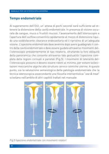 manuale per un'isteroscopia moderna - Ginecologia