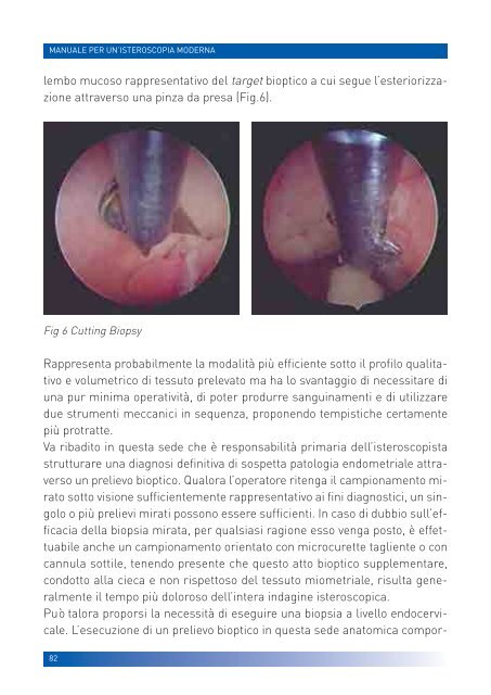 manuale per un'isteroscopia moderna - Ginecologia